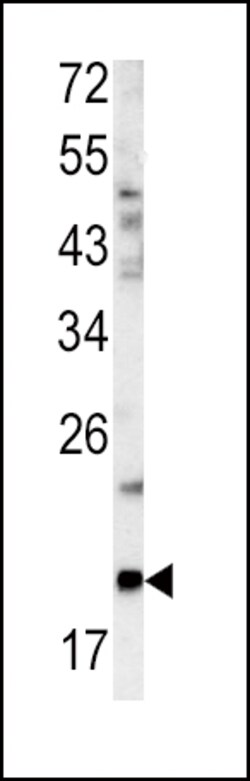 Invitrogen Glucagon Polyclonal Antibody 400 &mu;L; Unconjugated:Antibodies,
