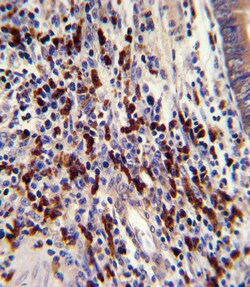 Invitrogen CNOT8 Polyclonal Antibody 400 &mu;L; Unconjugated:Antibodies,