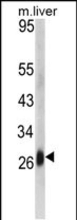 Invitrogen DCL-1 Polyclonal Antibody 400 &mu;L; Unconjugated:Antibodies,