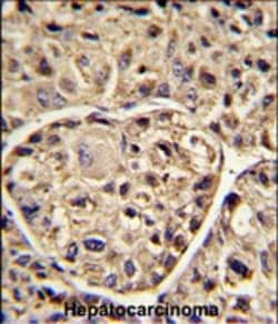 Invitrogen ELOVL6 Polyclonal Antibody 400 &mu;L; Unconjugated:Antibodies,