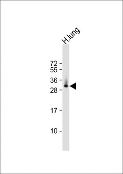Invitrogen ELOVL6 Polyclonal Antibody 400 &mu;L; Unconjugated:Antibodies,