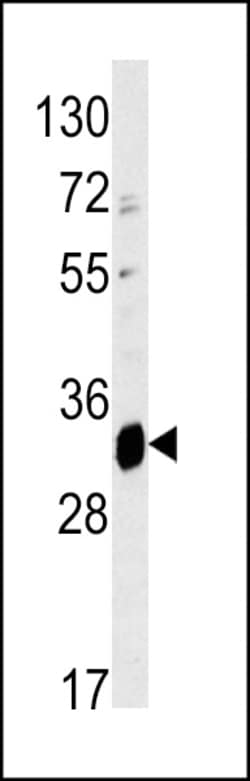 Invitrogen ELOVL6 Polyclonal Antibody 400 &mu;L; Unconjugated:Antibodies,