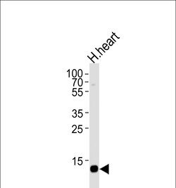 Invitrogen FABP3 Polyclonal Antibody 400 &mu;L; Unconjugated:Antikörper