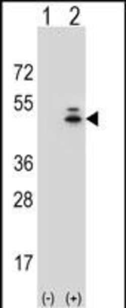 Invitrogen gamma Actin Polyclonal Antibody 400 &mu;L; Unconjugated:Antibodies,