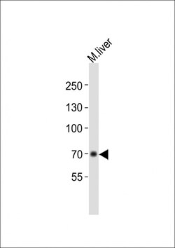 Invitrogen Albumin Polyclonal Antibody 200 &mu;L; Unconjugated:Antibodies,