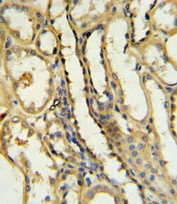 Invitrogen CD154 (CD40 Ligand) Polyclonal Antibody 400 &mu;L | Buy Online | Invitrogen&trade; | Fisher Scientific