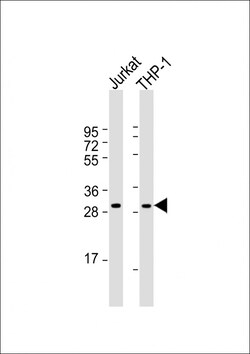 Invitrogen CD154 (CD40 Ligand) Polyclonal Antibody 400 &mu;L | Buy Online | Invitrogen&trade; | Fisher Scientific