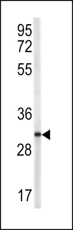 Invitrogen CD154 (CD40 Ligand) Polyclonal Antibody 400 &mu;L | Buy Online | Invitrogen&trade; | Fisher Scientific