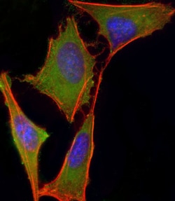 Invitrogen VHL Polyclonal Antibody 200 &mu;L; Unconjugated:Antibodies,