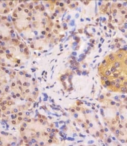 Invitrogen VHL Polyclonal Antibody 200 &mu;L; Unconjugated:Antibodies,
