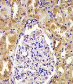 Invitrogen VHL Polyclonal Antibody 200 &mu;L; Unconjugated:Antibodies,