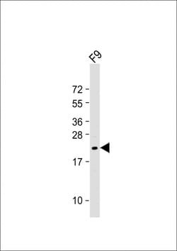 Invitrogen VHL Polyclonal Antibody 200 &mu;L; Unconjugated:Antibodies,