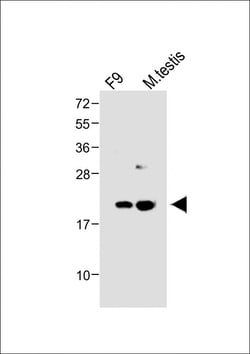 Invitrogen VHL Polyclonal Antibody 200 &mu;L; Unconjugated:Antibodies,