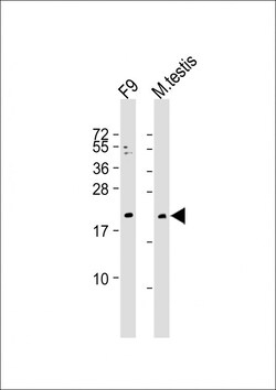 Invitrogen VHL Polyclonal Antibody 200 &mu;L; Unconjugated:Antibodies,