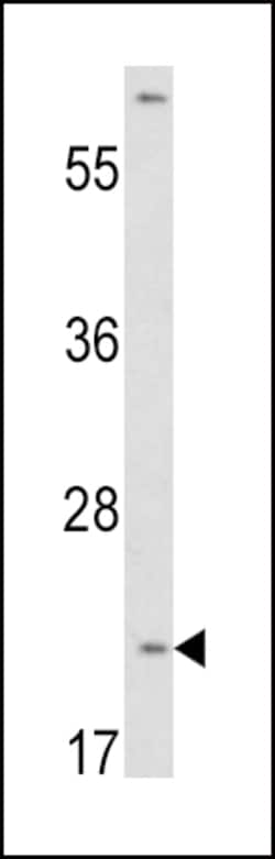 Invitrogen VHL Polyclonal Antibody 200 &mu;L; Unconjugated:Antibodies,