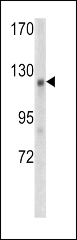 Invitrogen AMER1 Polyclonal Antibody 400 μL; Unconjugated:Antibodies,