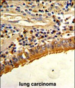 Invitrogen Osteopontin Polyclonal Antibody 400 &mu;L | Buy Online | Invitrogen&trade; | Fisher Scientific