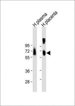 Invitrogen Osteopontin Polyclonal Antibody 400 &mu;L | Buy Online | Invitrogen&trade; | Fisher Scientific