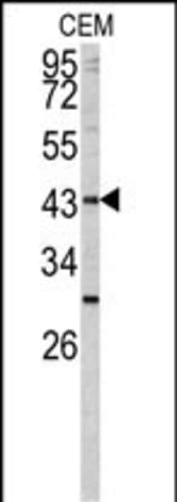 Invitrogen FUT1 Polyclonal Antibody 400 &mu;L; Unconjugated:Antibodies,