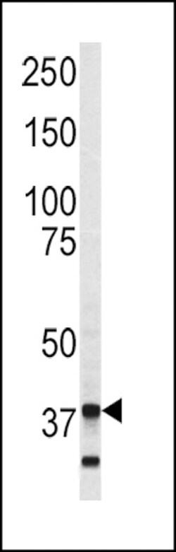 Invitrogen Annexin V Polyclonal Antibody 400 &mu;L | Buy Online | Invitrogen&trade; | Fisher Scientific