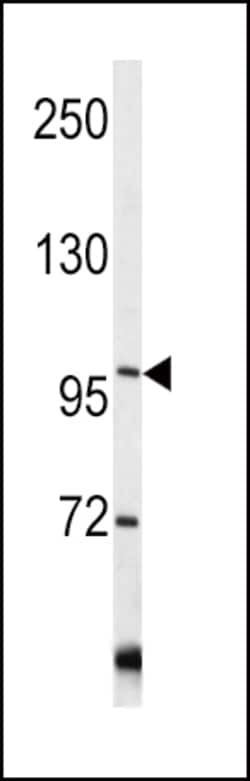 Invitrogen COL6A1 Polyclonal Antibody 400 &mu;L; Unconjugated:Antibodies,