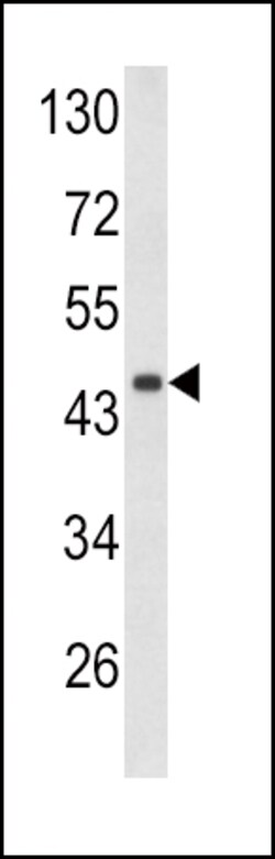 Invitrogen Decorin Polyclonal Antibody 400 &mu;L; Unconjugated:Antibodies,