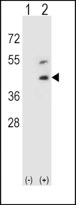 Invitrogen Decorin Polyclonal Antibody 400 &mu;L; Unconjugated:Antibodies,