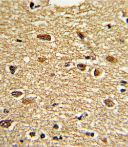Invitrogen ETV4 Polyclonal Antibody 400 &mu;L; Unconjugated:Antibodies,