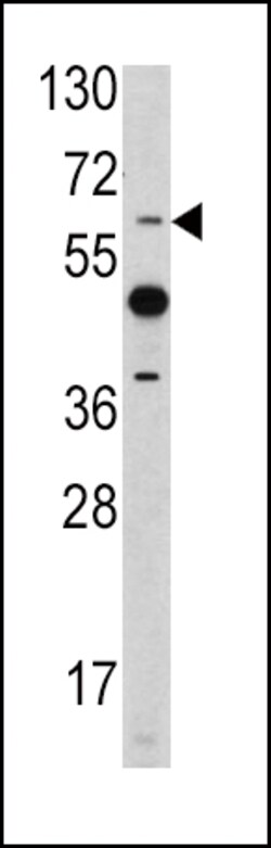 Invitrogen ETV4 Polyclonal Antibody 400 &mu;L; Unconjugated:Antibodies,