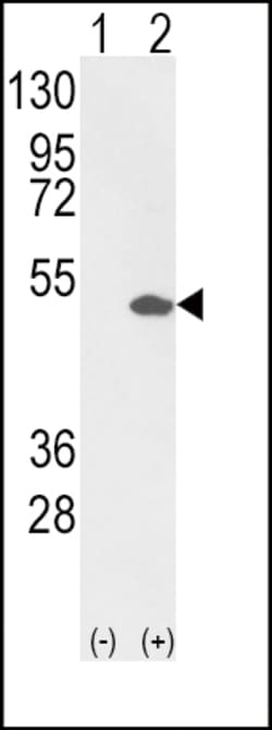 Invitrogen ETV4 Polyclonal Antibody 400 &mu;L; Unconjugated:Antibodies,