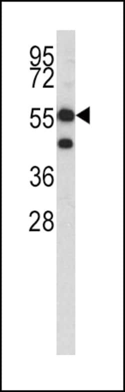 Invitrogen HMGCS1 Polyclonal Antibody 400 &mu;L; Unconjugated:Antibodies,