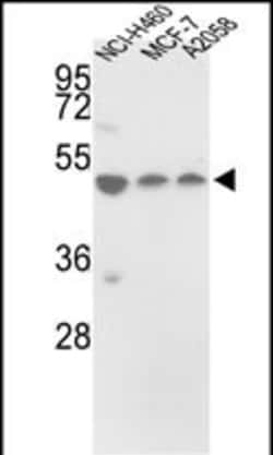 Invitrogen PDIA6 Polyclonal Antibody 400 &mu;L; Unconjugated:Antibodies,
