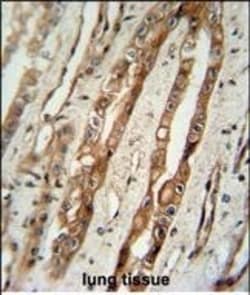 Invitrogen C1 inhibitor Polyclonal Antibody 400 &mu;L; Unconjugated:Antibodies,