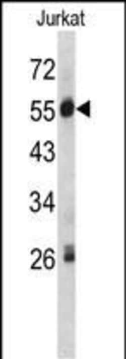 Invitrogen C1 inhibitor Polyclonal Antibody 400 &mu;L; Unconjugated:Antibodies,