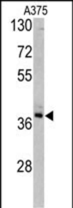 Invitrogen TALDO1 Polyclonal Antibody 400 &mu;L; Unconjugated:Antibodies,