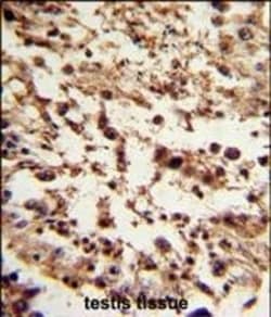Invitrogen TBP Polyclonal Antibody 400 &mu;L | Buy Online | Invitrogen&trade; | Fisher Scientific