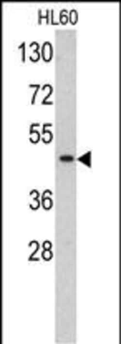 Invitrogen TBP Polyclonal Antibody 400 &mu;L | Buy Online | Invitrogen&trade; | Fisher Scientific