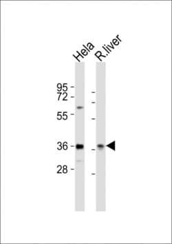 Invitrogen PAX4 Polyclonal Antibody 400 &mu;L; Unconjugated:Antibodies,