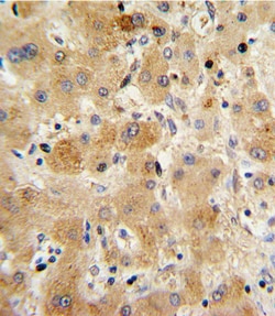 Invitrogen Transthyretin Polyclonal Antibody 400 &mu;L; Unconjugated:Antibodies,