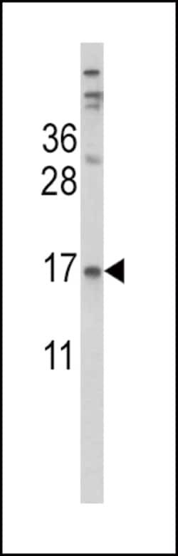 Invitrogen Transthyretin Polyclonal Antibody 400 &mu;L; Unconjugated:Antibodies,