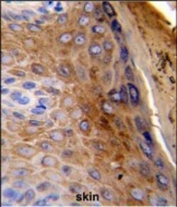 Invitrogen Cytokeratin 10 Polyclonal Antibody 400 &mu;L; Unconjugated:Antibodies,