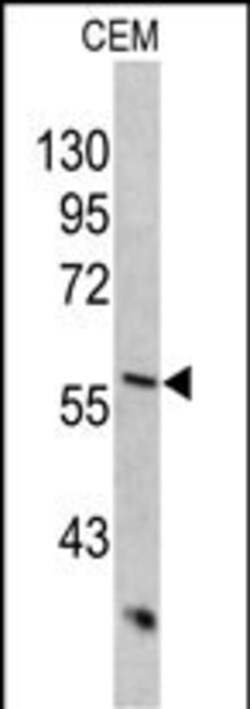 Invitrogen Cytokeratin 10 Polyclonal Antibody 400 &mu;L; Unconjugated:Antibodies,