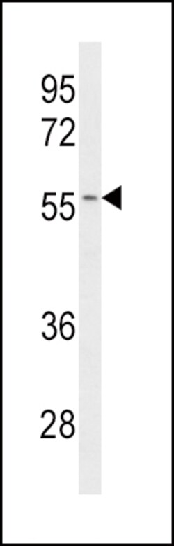 Invitrogen CYP2C19 Polyclonal Antibody 400 &mu;L; Unconjugated:Antibodies,