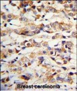 Invitrogen Cytokeratin 14 Polyclonal Antibody 400 &mu;L; Unconjugated:Antibodies,