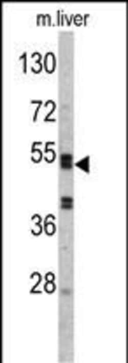 Invitrogen SERPINC1 Polyclonal Antibody 400 &mu;L; Unconjugated:Antibodies,