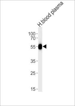 Invitrogen SERPINC1 Polyclonal Antibody 400 &mu;L; Unconjugated:Antibodies,