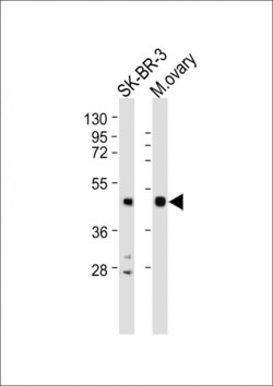 Invitrogen INHA Polyclonal Antibody 400 &mu;L | Buy Online | Invitrogen&trade; | Fisher Scientific