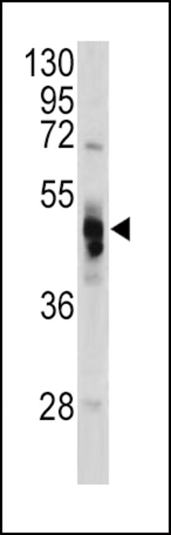 Invitrogen alpha Galactosidase Polyclonal Antibody 400 &mu;L; Unconjugated:Antibodies,