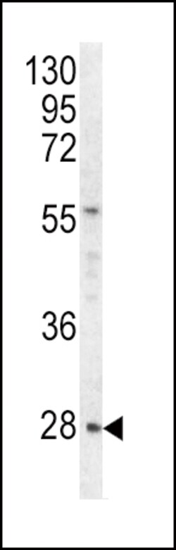 Invitrogen HPRT1 Polyclonal Antibody 400 &mu;L; Unconjugated:Antibodies,