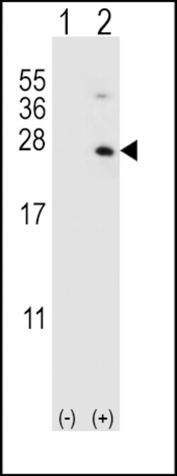 Invitrogen HPRT1 Polyclonal Antibody 400 &mu;L; Unconjugated:Antibodies,